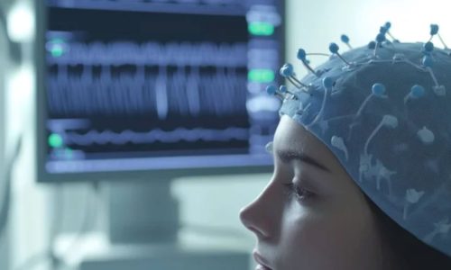 Hollywood Detox – Website – EMBP Brain Evaluation